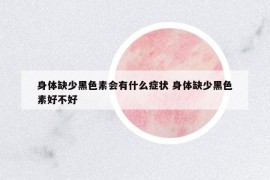 身體缺少黑色素會有什么癥狀 身體缺少黑色素好不好
