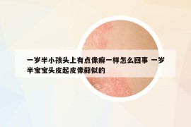 一歲半小孩頭上有點(diǎn)像癬一樣怎么回事 一歲半寶寶頭皮起皮像蘚似的