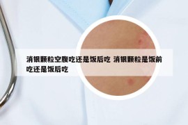 消銀顆粒空腹吃還是飯后吃 消銀顆粒是飯前吃還是飯后吃