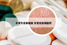東營(yíng)牛皮癬健康 東營(yíng)皮膚病醫(yī)院