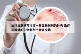 治療皮膚病可以打一種生物制劑的針嗎 治療皮膚病的生物制劑一針多少錢