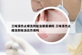 三味清熱止癢洗劑能治銀屑病嗎 三味清熱止癢洗劑有消炎作用嗎