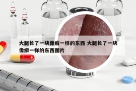 大腿長(zhǎng)了一塊像癬一樣的東西 大腿長(zhǎng)了一塊像癬一樣的東西圖片