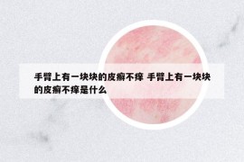 手臂上有一塊塊的皮癬不癢 手臂上有一塊塊的皮癬不癢是什么