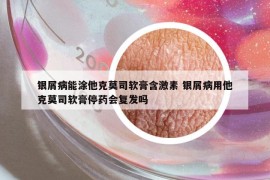 銀屑病能涂他克莫司軟膏含激素 銀屑病用他克莫司軟膏停藥會復(fù)發(fā)嗎