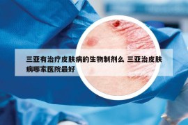 三亞有治療皮膚病的生物制劑么 三亞治皮膚病哪家醫(yī)院最好