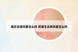 康王去屑效果怎么樣 屑康王去屑效果怎么樣