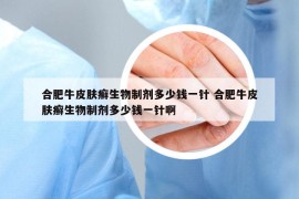 合肥牛皮膚癬生物制劑多少錢一針 合肥牛皮膚癬生物制劑多少錢一針啊