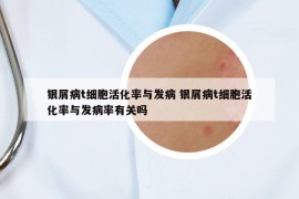銀屑病t細(xì)胞活化率與發(fā)病 銀屑病t細(xì)胞活化率與發(fā)病率有關(guān)嗎