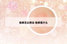 胎癬怎么根治 胎癬是什么