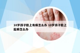 10歲孩子臉上有癬怎么辦 10歲孩子臉上起癬怎么辦