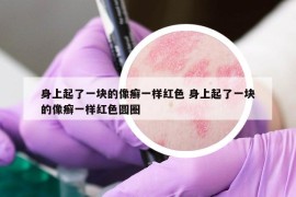 身上起了一塊的像癬一樣紅色 身上起了一塊的像癬一樣紅色圓圈