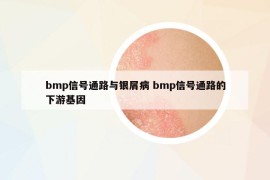 bmp信號通路與銀屑病 bmp信號通路的下游基因