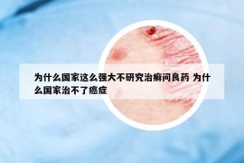 為什么國家這么強大不研究治癬問良藥 為什么國家治不了癌癥