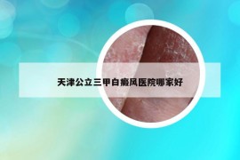天津公立三甲白癜風(fēng)醫(yī)院哪家好