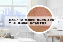 身上起了一塊一塊的像癬一樣紅色癢 身上起了一塊一塊的像癬一樣紅色越來越多