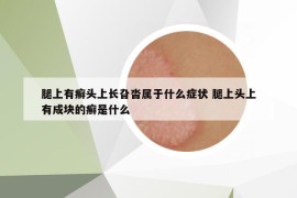 腿上有癬頭上長旮沓屬于什么癥狀 腿上頭上有成塊的癬是什么