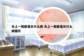 頭上一般都是長(zhǎng)什么癬 頭上一般都是長(zhǎng)什么癬圖片