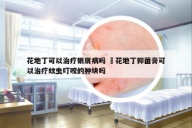 花地丁可以治療銀屑病嗎 橴花地丁抑菌膏可以治療蚊蟲(chóng)叮咬的腫塊嗎