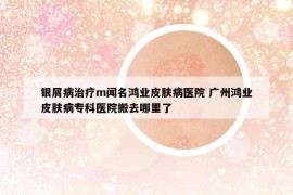 銀屑病治療m聞名鴻業(yè)皮膚病醫(yī)院 廣州鴻業(yè)皮膚病?？漆t(yī)院搬去哪里了