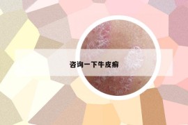 咨詢一下牛皮癬
