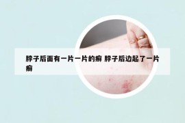 脖子后面有一片一片的癬 脖子后邊起了一片癬