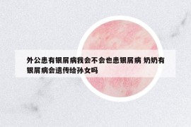 外公患有銀屑病我會不會也患銀屑病 奶奶有銀屑病會遺傳給孫女嗎
