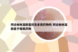 阿達(dá)帕林凝膠是抗生素類藥物嗎 阿達(dá)帕林凝膠屬于哪類藥物