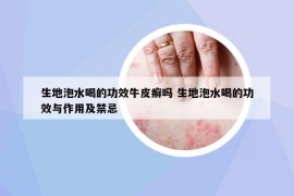 生地泡水喝的功效牛皮癬嗎 生地泡水喝的功效與作用及禁忌