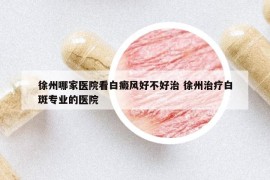 徐州哪家醫(yī)院看白癜風(fēng)好不好治 徐州治療白斑專業(yè)的醫(yī)院
