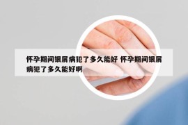 懷孕期間銀屑病犯了多久能好 懷孕期間銀屑病犯了多久能好啊