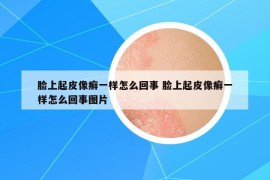 臉上起皮像癬一樣怎么回事 臉上起皮像癬一樣怎么回事圖片