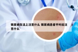 銀屑病生活上注意什么 銀屑病患者平時(shí)應(yīng)注意什么