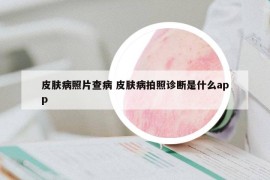 皮膚病照片查病 皮膚病拍照診斷是什么app