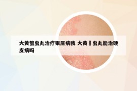 大黃螫蟲丸治療銀屑病我 大黃?蟲丸能治硬皮病嗎