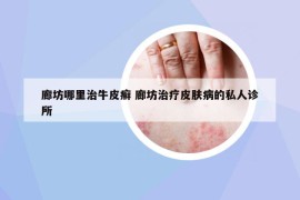 廊坊哪里治牛皮癬 廊坊治療皮膚病的私人診所