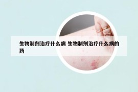 生物制劑治療什么病 生物制劑治療什么病的藥