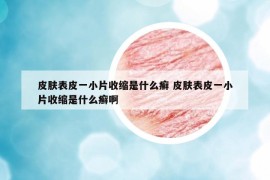 皮膚表皮一小片收縮是什么癬 皮膚表皮一小片收縮是什么癬啊