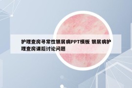 護(hù)理查房尋常性銀屑病PPT模板 銀屑病護(hù)理查房課后討論問(wèn)題