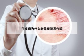 牛皮癬為什么老是反復發(fā)作呢