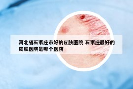 河北省石家莊市好的皮膚醫(yī)院 石家莊最好的皮膚醫(yī)院是哪個醫(yī)院