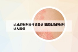 pi3k抑制劑治療銀屑病 銀屑生物抑制劑進入醫(yī)保