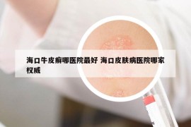 ?？谂Ｆぐ_哪醫(yī)院最好 ?？谄つw病醫(yī)院哪家權(quán)威