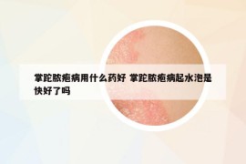 掌跎膿皰病用什么藥好 掌跎膿皰病起水泡是快好了嗎