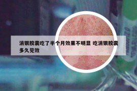 消銀膠囊吃了半個月效果不明顯 吃消銀膠囊多久見效