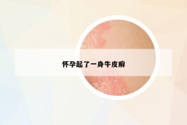 懷孕起了一身牛皮癬