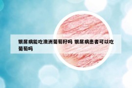 銀屑病能吃澳洲葡萄籽嗎 銀屑病患者可以吃葡萄嗎