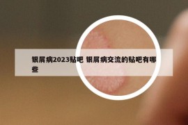 銀屑病2023貼吧 銀屑病交流的貼吧有哪些