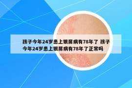 孩子今年24歲患上銀屑病有78年了 孩子今年24歲患上銀屑病有78年了正常嗎