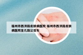 福州市西洪路皮膚病醫(yī)院 福州市西洪路皮膚病醫(yī)院坐幾路公交車